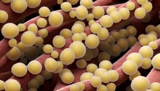 金黄色葡萄球菌检测中常见的问题与成因及解决方案与操作！