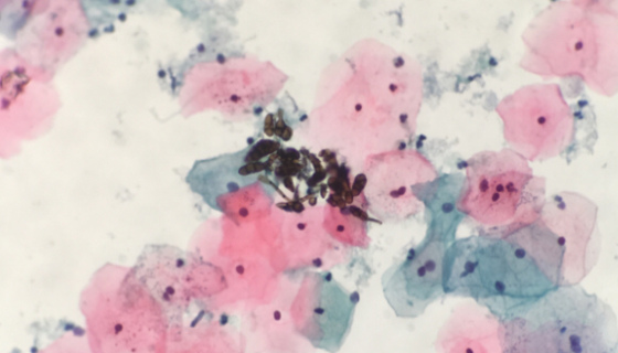 小鼠子宫内膜干细胞培养过程中需要注意的细节有哪些？