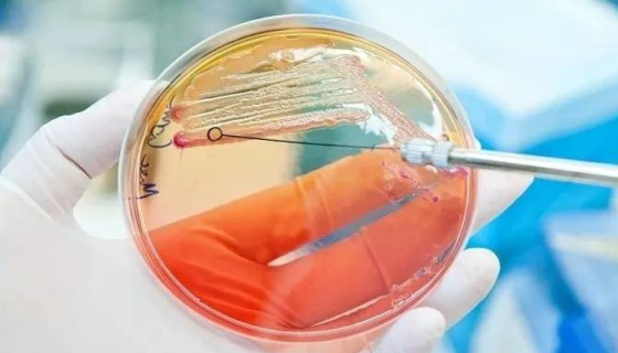 红色长孢链霉菌在哪些方面有应用前景？核心优势有哪些？