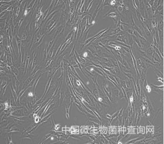 HSFSV40转染 人真皮成纤维细胞永生化