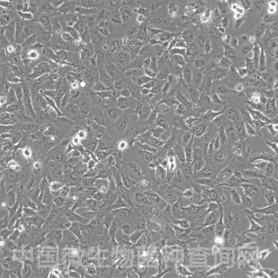 人纤维肉瘤细胞