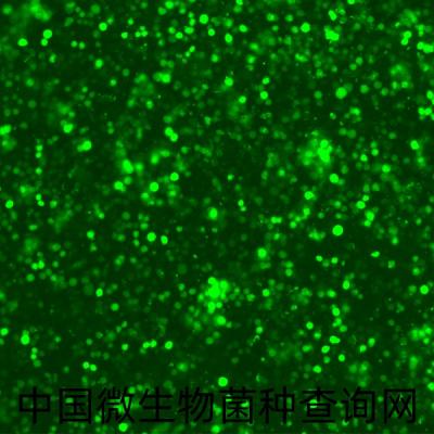 人单核白血病细胞带绿色荧光
