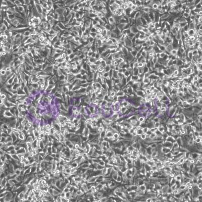 小鼠黑色素瘤细胞荧光素酶标记