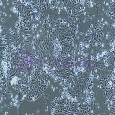 小鼠原代Ⅱ型肺泡上皮细胞