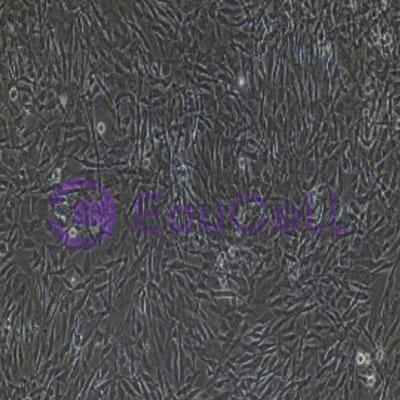 人原代Ⅱ型肺泡上皮细胞