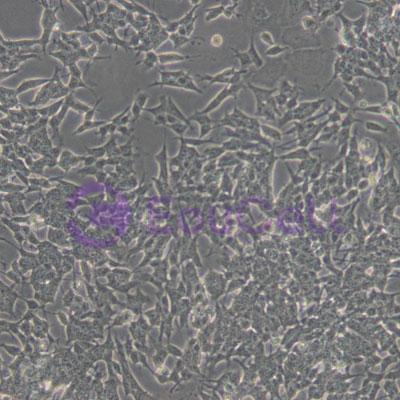 永生化食管上皮细胞