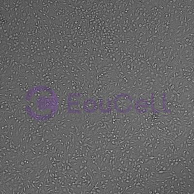 大鼠胶质瘤细胞