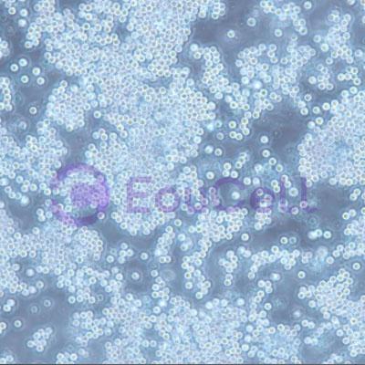 小鼠骨髓瘤细胞