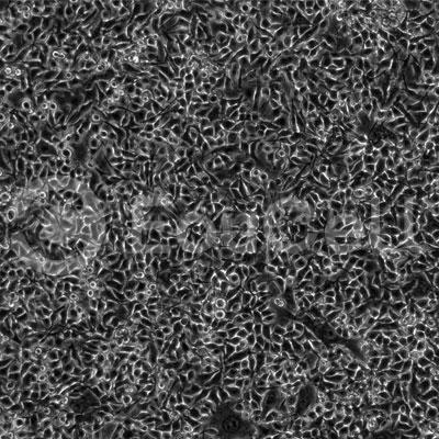 小鼠黑色素瘤细胞