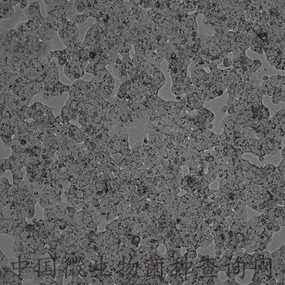 T47D 人乳腺導(dǎo)管癌細(xì)胞