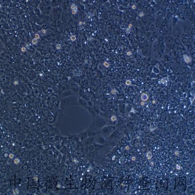 人胰腺癌細(xì)胞