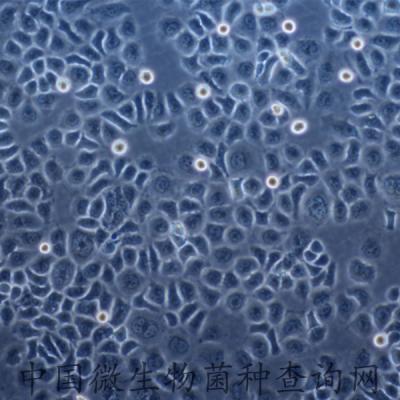 人腎上腺皮質(zhì)癌細(xì)胞（DMEM）