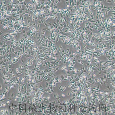 人腦神經(jīng)母細(xì)胞