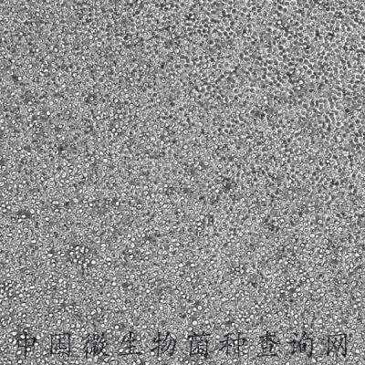 小鼠髓性白血病淋巴細(xì)胞/小鼠白血病G-CSF依賴(lài)性細(xì)胞